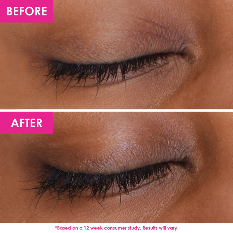 GrandeLASH-MD | Lash Enhancing Serum
