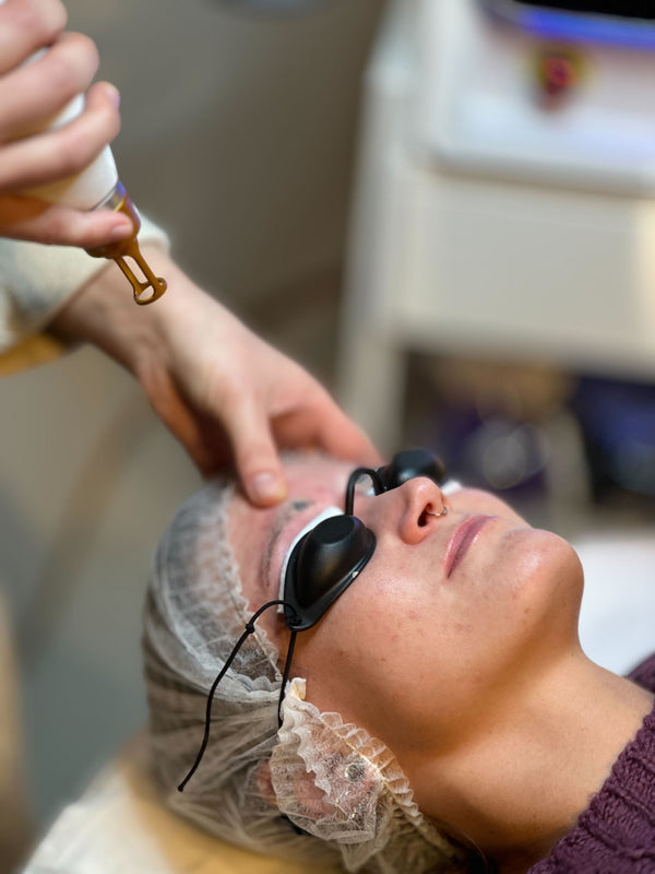 Permanent-fjerning med laser